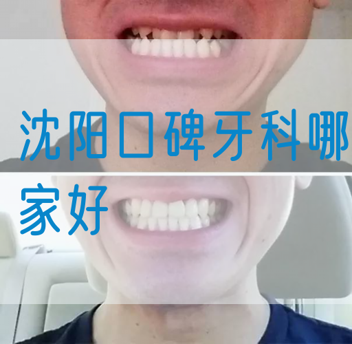 沈阳口碑牙科哪家好
