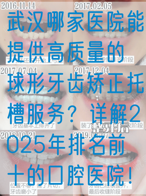 武汉哪家医院能提供高质量的球形牙齿矫正托槽服务？详解2025年排名前十的口腔医院！