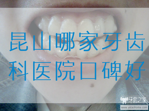昆山哪家牙齿科医院口碑好