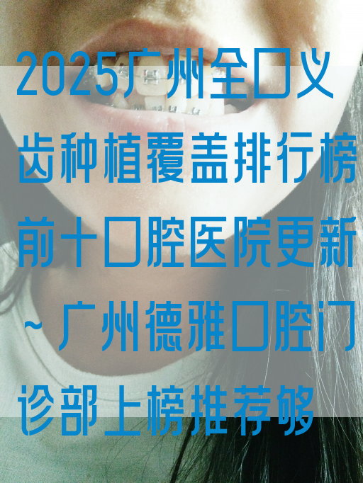 2025广州全口义齿种植覆盖排行榜前十口腔医院更新~广州德雅口腔门诊部上榜推荐够