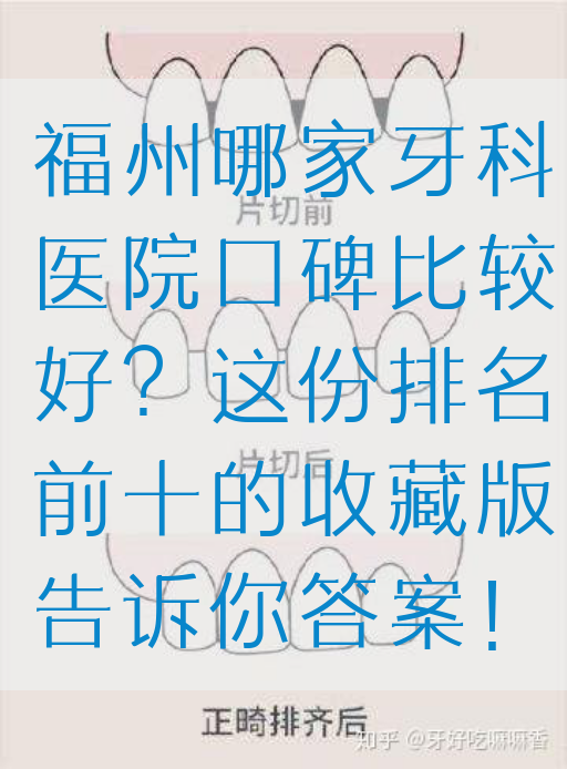 福州哪家牙科医院口碑比较好？这份排名前十的收藏版告诉你答案！