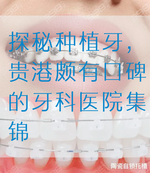 探秘种植牙，贵港颇有口碑的牙科医院集锦