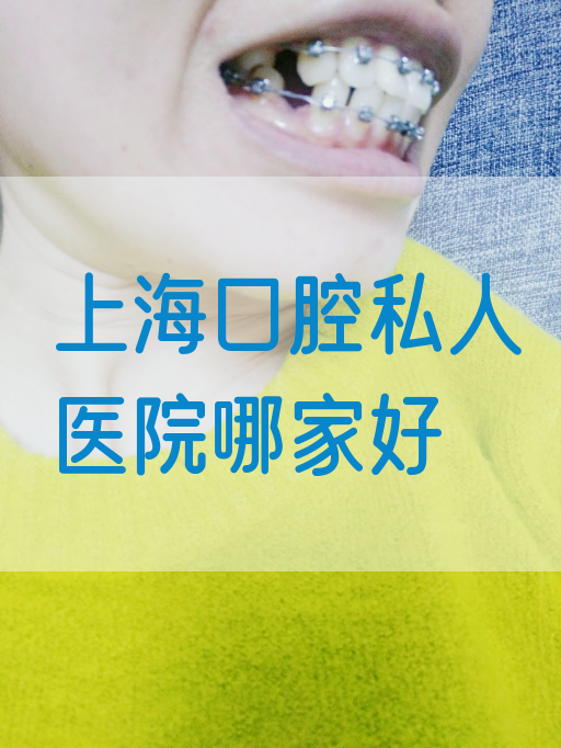 上海口腔私人医院哪家好