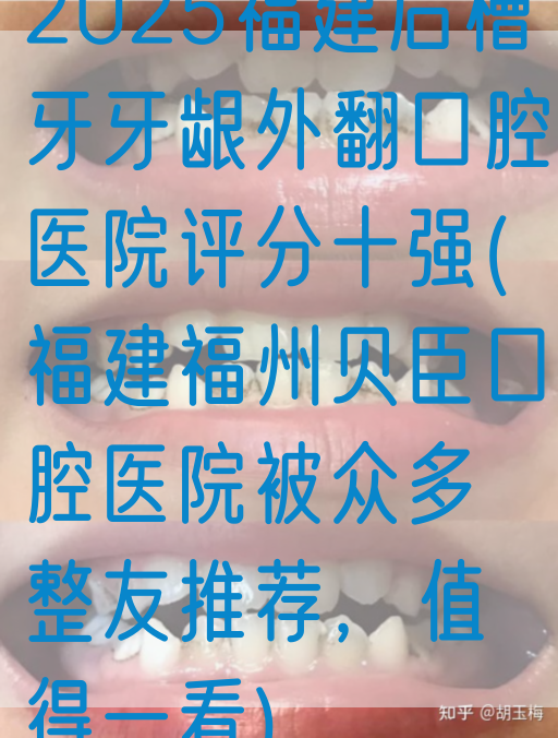 2025福建后槽牙牙龈外翻口腔医院评分十强(福建福州贝臣口腔医院被众多整友推荐，值得一看)