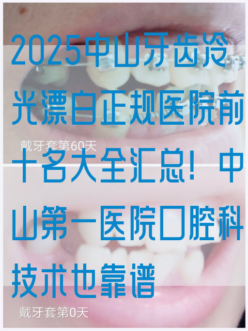 2025中山牙齿冷光漂白正规医院前十名大全汇总！中山第一医院口腔科技术也靠谱