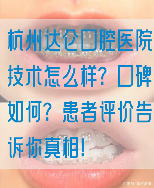 杭州达仑口腔医院技术怎么样？口碑如何？患者评价告诉你真相！