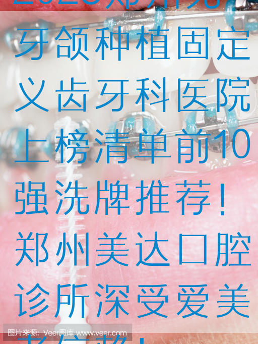 2025郑州无牙颌种植固定义齿牙科医院上榜清单前10强洗牌推荐！郑州美达口腔诊所深受爱美者信赖！