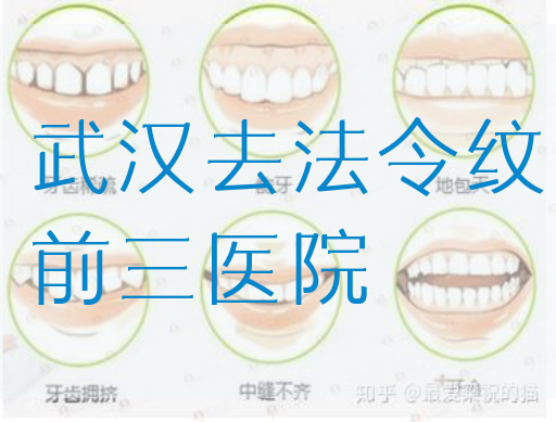 武汉去法令纹前三医院