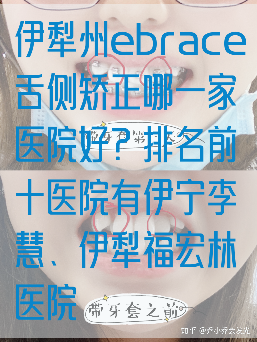 伊犁州ebrace舌侧矫正哪一家医院好？排名前十医院有伊宁李慧、伊犁福宏林医院