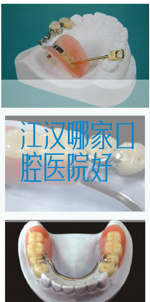 江汉哪家口腔医院好