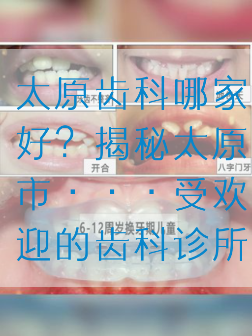 太原齿科哪家好？揭秘太原市···受欢迎的齿科诊所