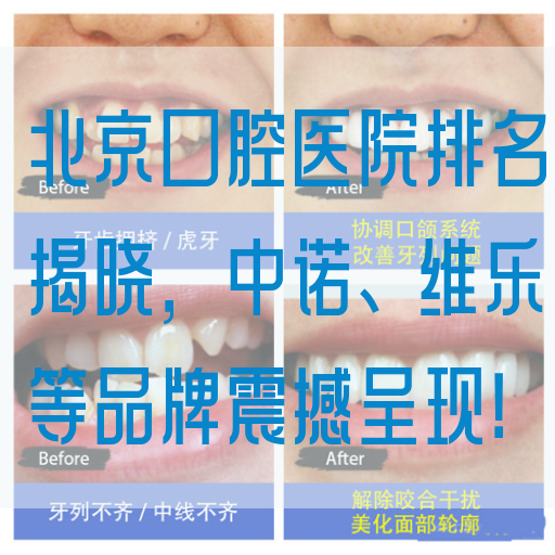 北京口腔医院排名揭晓，中诺、维乐等品牌震撼呈现！