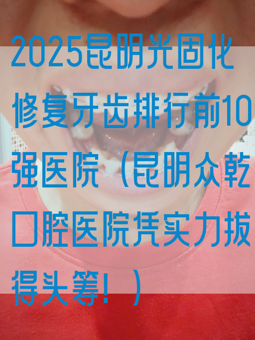 2025昆明光固化修复牙齿排行前10强医院(昆明众乾口腔医院凭实力拔得*筹！)
