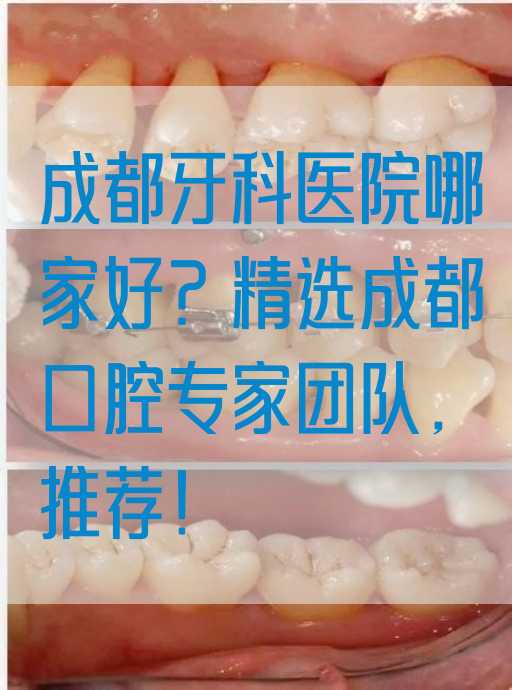 成都牙科医院哪家好？*选成都口腔专家团队，推荐！