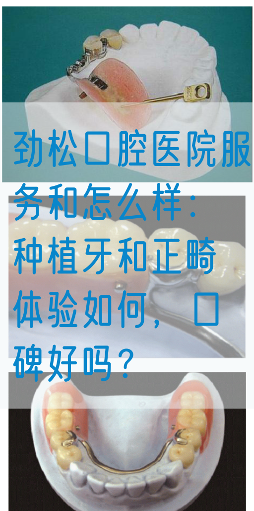 劲松口腔医院服务和怎么样：种植牙和正畸体验如何，口碑好吗？