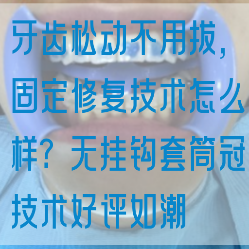牙齿松动不用拔，固定修复技术怎么样？无挂钩套筒冠技术好评如潮