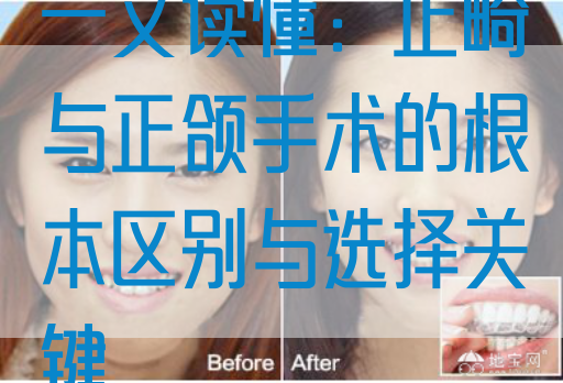 一文读懂：正畸与正颌手术的根本区别与选择关键