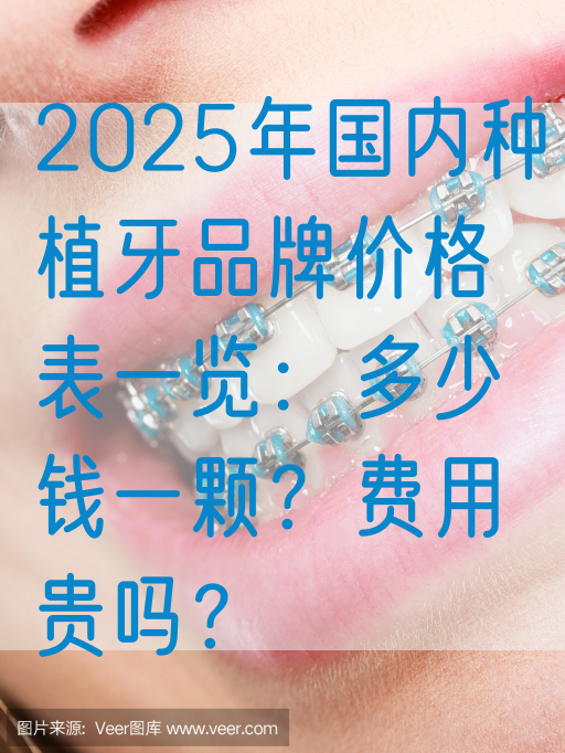 2025年国内种植牙品牌价格表一览：多少钱一颗？费用贵吗？