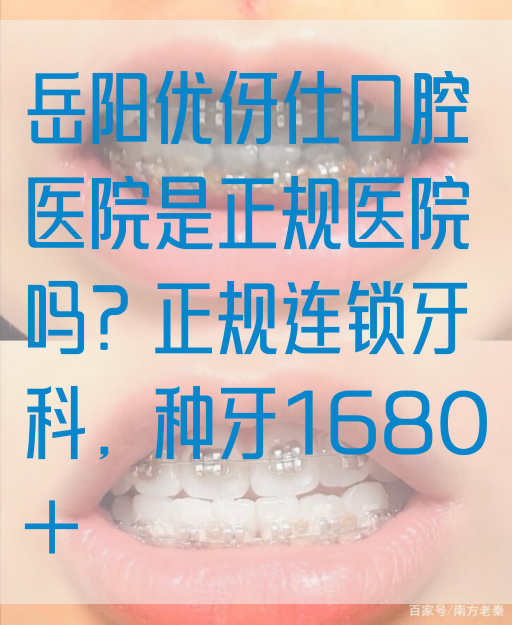 岳阳优伢仕口腔医院是正规医院吗？正规连锁牙科，种牙1680+