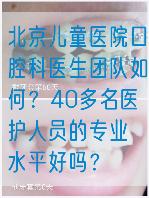 北京儿童医院口腔科医生团队如何？40多名医护人员的专业水平好吗？