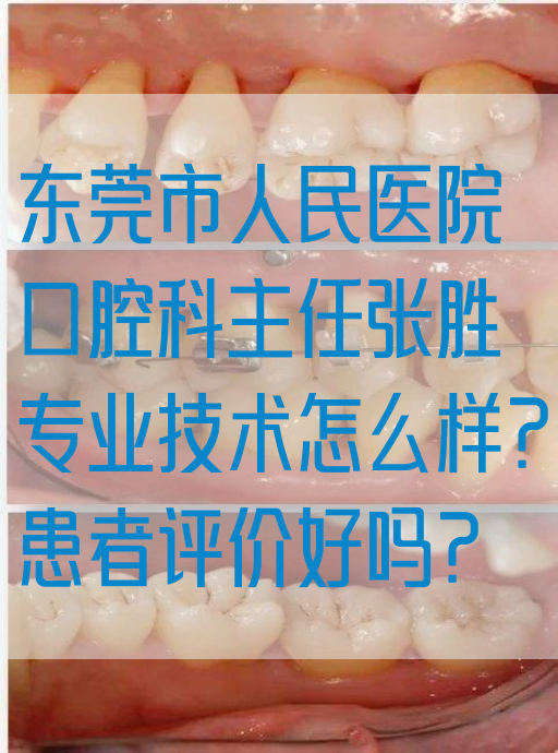 东莞市人民医院口腔科主任张胜专业技术怎么样？患者评价好吗？