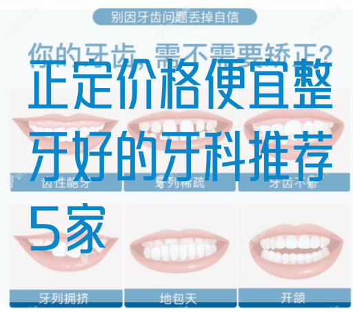 正定价格便宜整牙好的牙科推荐5家