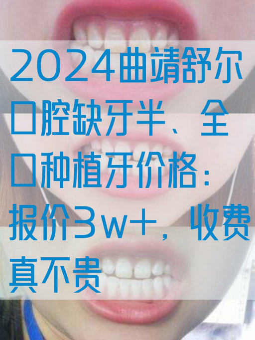 2024曲靖舒尔口腔缺牙半、全口种植牙价格：报价3w+，收费真不贵