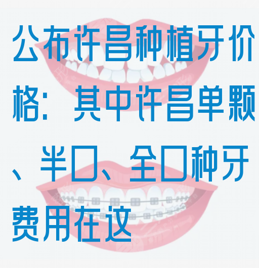公布许昌种植牙价格：其中许昌单颗、半口、全口种牙费用在这