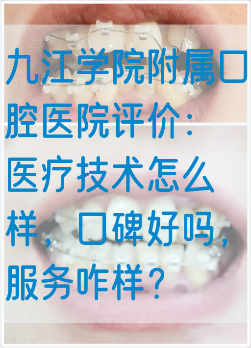 九江学院附属口腔医院评价：医疗技术怎么样，口碑好吗，服务咋样？