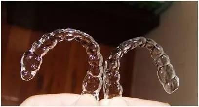 矫正牙齿6000块可靠吗？可靠，金属自锁托槽6000元是正常的(图2)