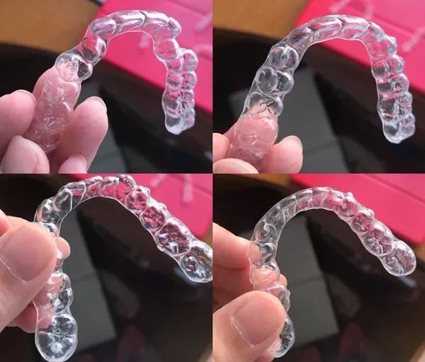 隐形牙套和传统牙套矫正哪个更快？正畸速度快慢竟和它有关(图3)
