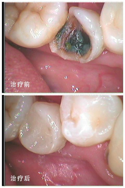 上海泗泾医院口腔科预约挂号、上班时间、电话号码、价格查询(图1)