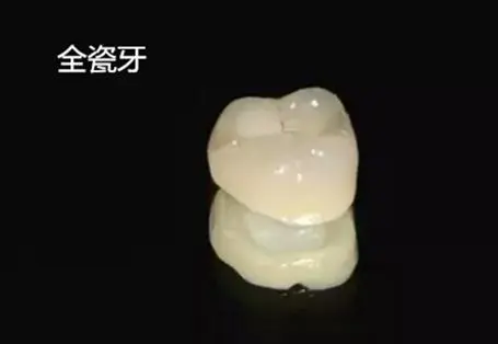 纯钛牙冠和全瓷牙冠哪个贵？全瓷牙冠集采后656元起、美观性好(图3)