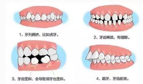 苏州牙科门诊补牙费用大揭秘：一颗补牙多少钱？各种材料价格表一览(图1)