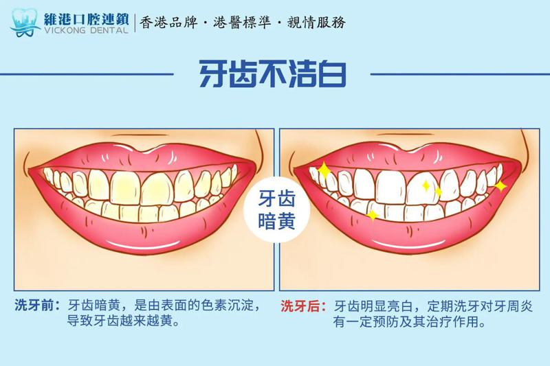 上海同仁医院正畸科技术怎么样？口腔矫正服务及费用全面解析(图1)