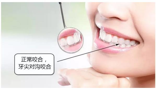 牙齿美白贴面价格表：了解不同类型贴面的价格与性价比，是否值得投资？(图1)