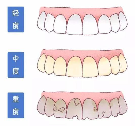 牙齿根管治疗期间饮食如何调整？医生的专业建议和注意事项解析(图1)
