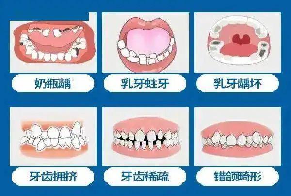 小榄人民医院牙齿矫正费用明细及价目表，了解矫正牙齿需要多少钱(图1)