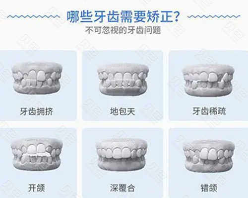 江阴祝塘口腔医院技术怎么样？在当地口碑好吗？全面解析(图1)