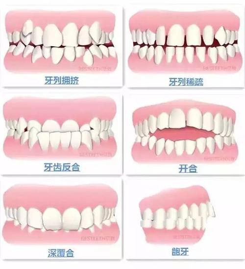 广州市荔湾区口腔医院收费标准一览：看牙费用多少，价格表公开，性价比如何？(图1)