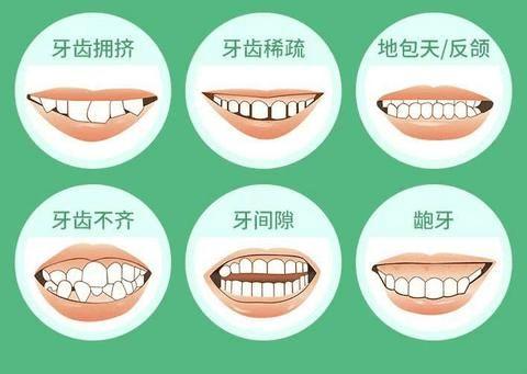 探讨上牙与下牙的正确位置及适宜缝隙：牙齿矫正技术怎么样？牙科专家口碑如何？(图1)