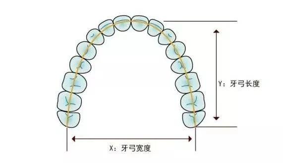 牙齿矫正拔牙是否值得？了解正畸费用多少及口腔矫正价格表一览(图1)