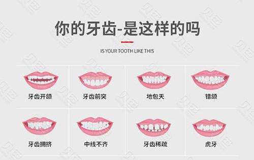 深圳牙齿矫正价格表：私立牙科矫正优惠多，价格表及补贴政策详解(图1)