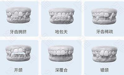 304医院口腔科正畸技术如何？拥有悠久历史，科室齐全，专家团队专业吗？(图1)