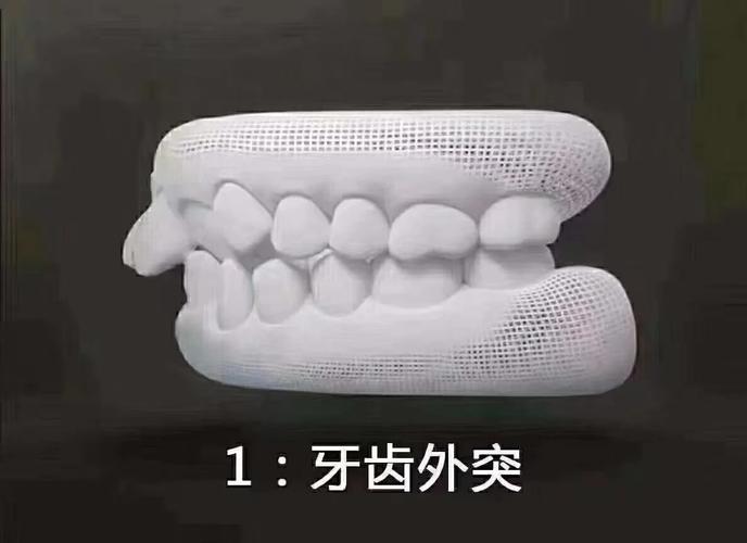 丽水口腔医疗收费一览：种植牙、牙齿矫正、拔牙等费用详细解析，价格表大揭秘(图1)