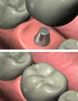 新区医院牙科种牙技术怎么样？作为二甲医院，其实力和口碑如何(图1)