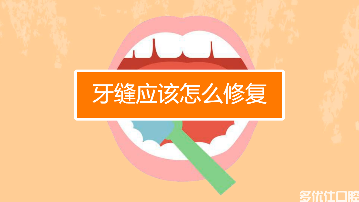 a3d3af3668937fdf15a85bc66de79d57.jpg