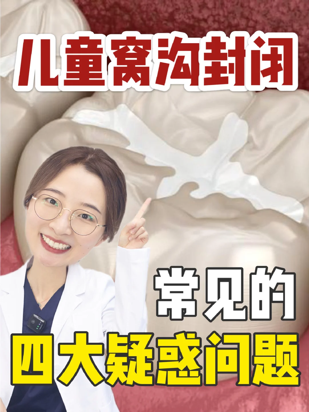 关于窝沟封闭的四大疑惑 有你想问的吗？
