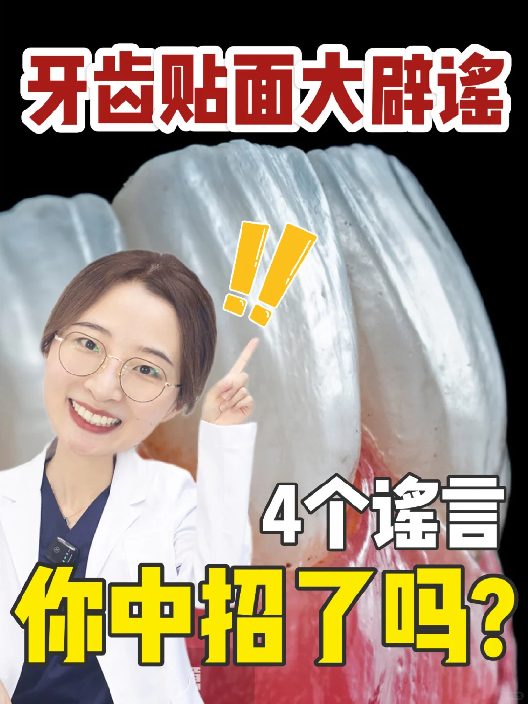 牙贴面四大谣言在线辟谣 看看你中招了吗？