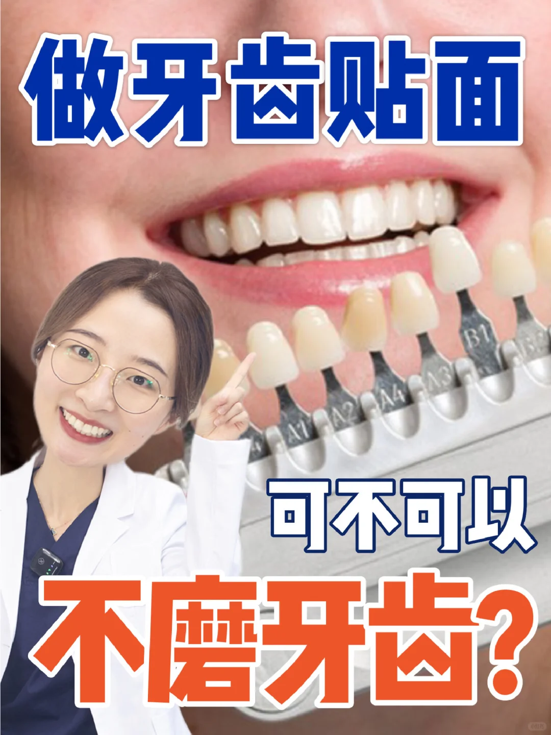 做牙贴面一定要磨牙吗？口腔博士来解惑！